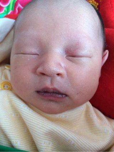 新生兒嘴唇發紫 (48) 