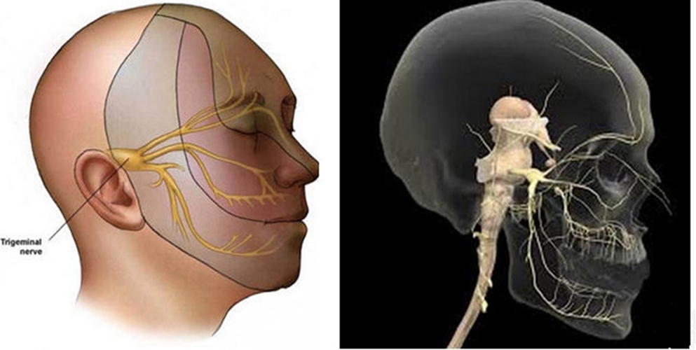 牙痛引起三叉神經痛怎麼辦