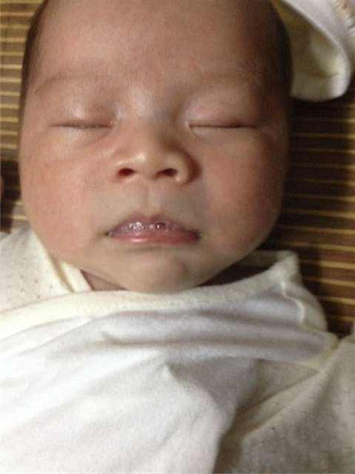 新生兒肺炎吐泡泡 (34) 