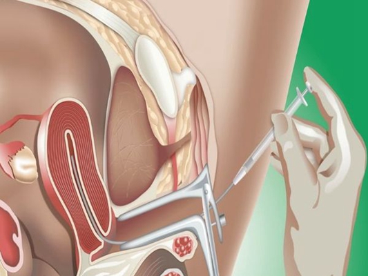 人工受完孕的過程 (42) 