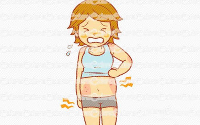 外陰溼疹的表現 