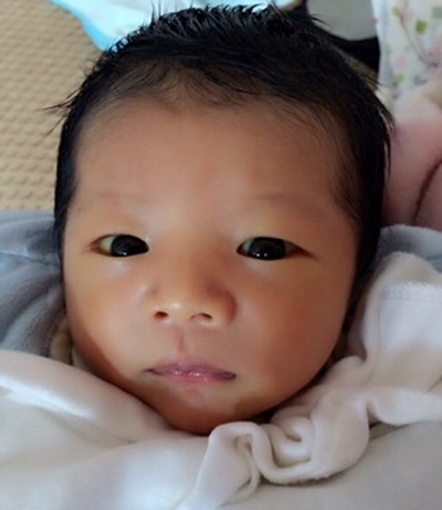 嬰兒嘴唇發紫 (47) 