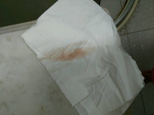 先兆流產分泌物