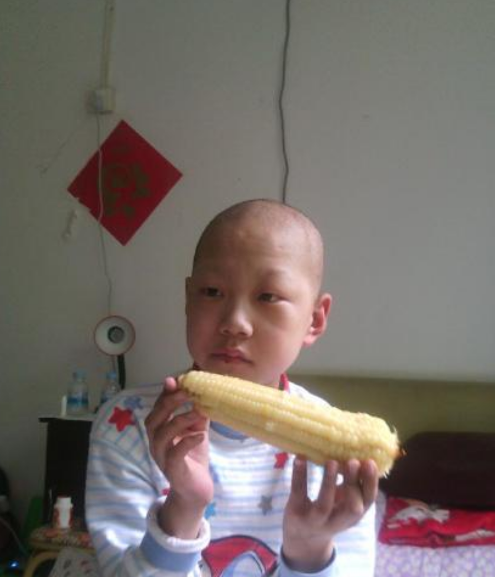 腦部良性淋巴瘤症狀 