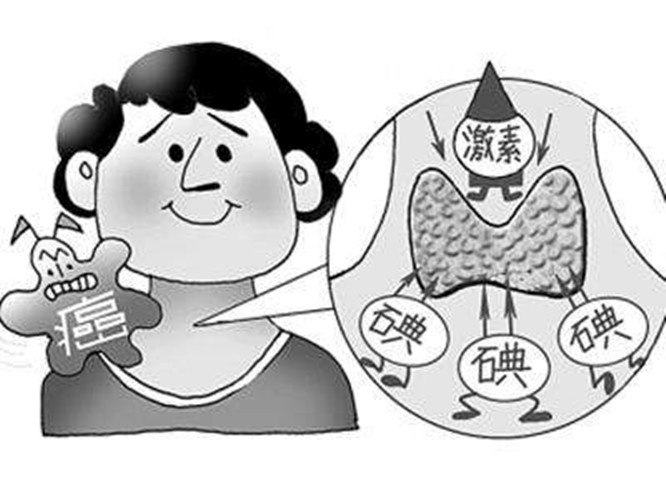 甲狀腺癌術後吃什麼 