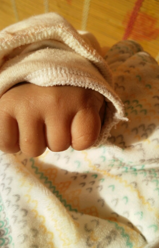 寶寶手上長水泡