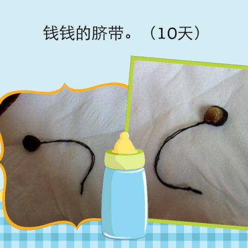 新生兒肚臍脫落圖 (5) 