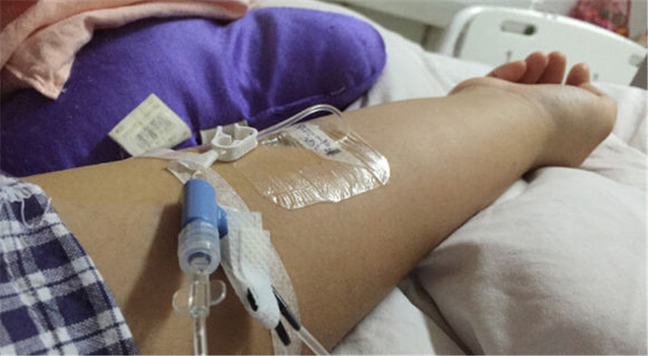 治療急性胰腺炎