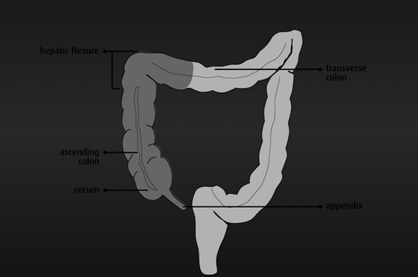 盲腸的位置 (31) 