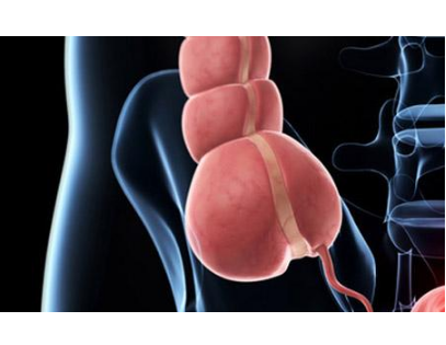 闌尾炎的症狀表現 (9) 