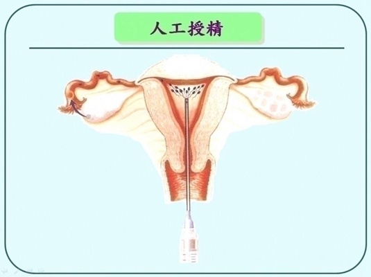 人工受完孕的過程 (41) 