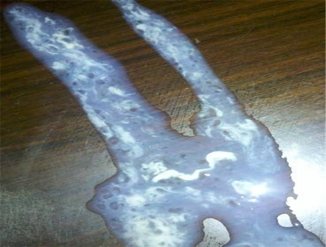 正常精子形態百分比 