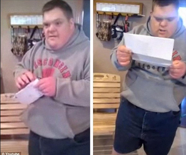 易位型唐氏綜合症