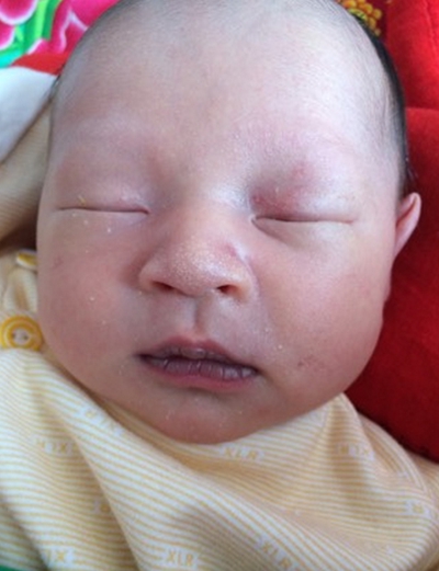 嬰兒嘴唇發紫 (45) 