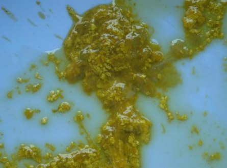 新生兒腹瀉大便