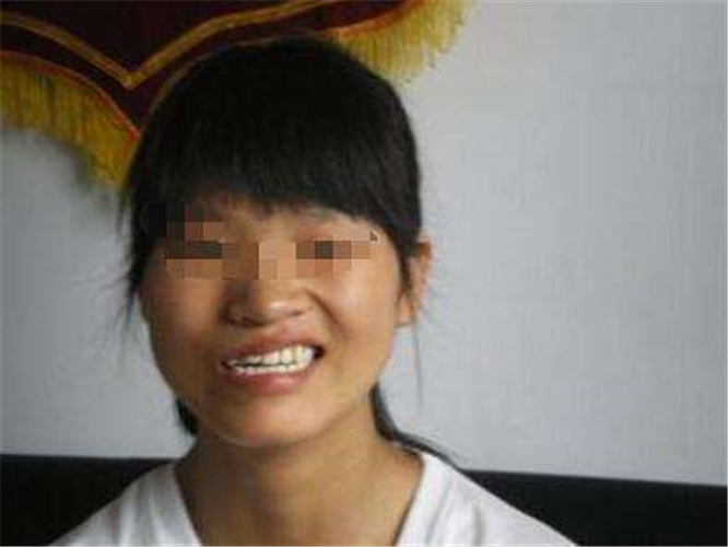 早期腦梗塞症狀