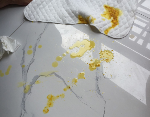 新生兒腹瀉大便