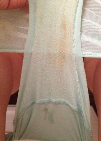 白帶帶有褐色分泌物 (8) 