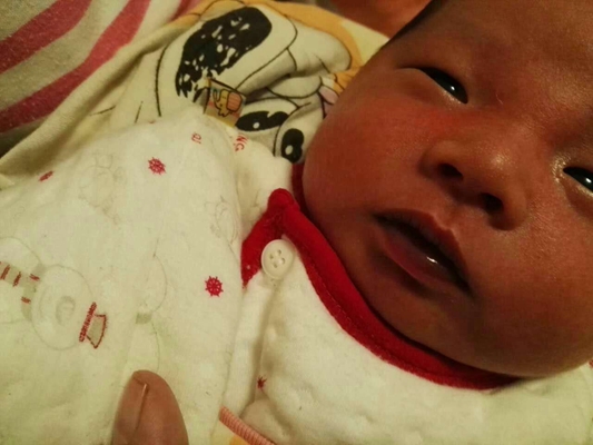 新生兒嘴唇發紫 (7) 