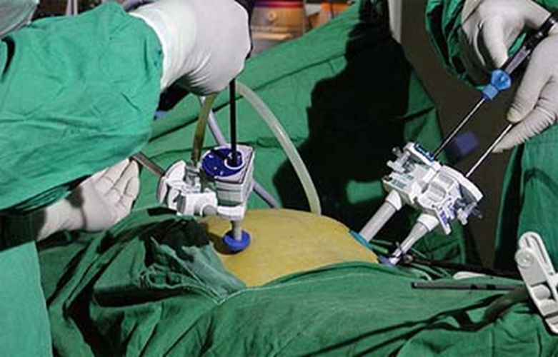 雙側巧克力囊腫