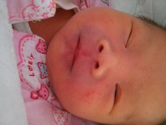 新生兒嘴唇發紫 (44) 