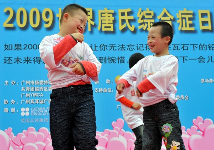 小兒唐氏綜合徵