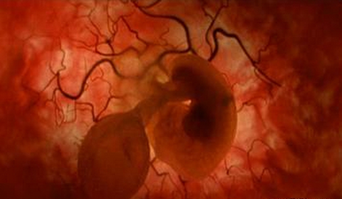 胎兒發育圖 (90) 