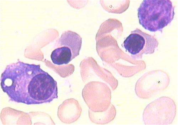 再生障礙性貧血細胞