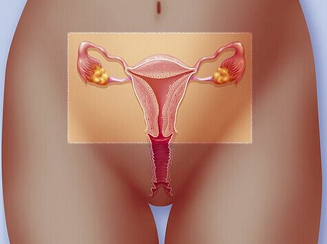 子宮脫垂生殖器