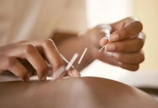 針灸治療急性乳腺炎