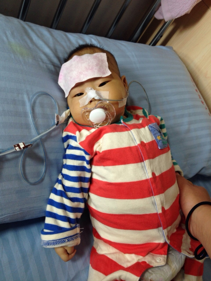 新生兒早期腹水