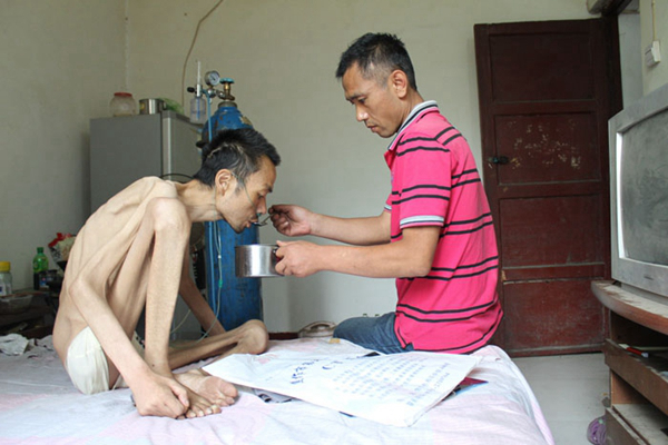 身體消瘦的原因 (80) 