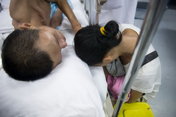 身體消瘦的原因 (77) 