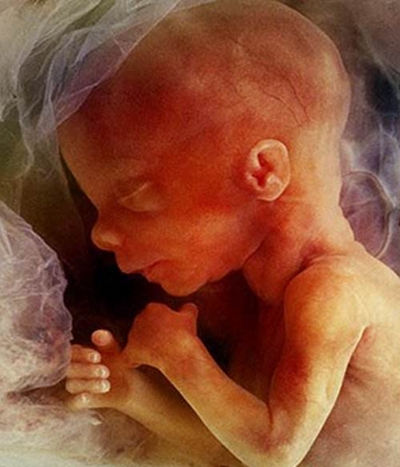 胎兒發育圖 (87) 