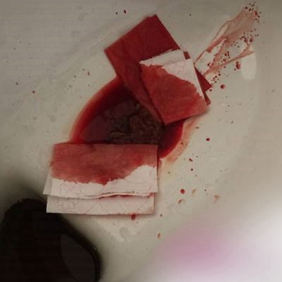 直腸癌晚期症狀 (50) 