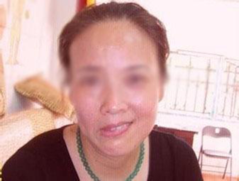 中年女性面肌痙攣