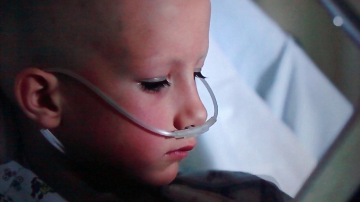 兒童白血病 (40) 