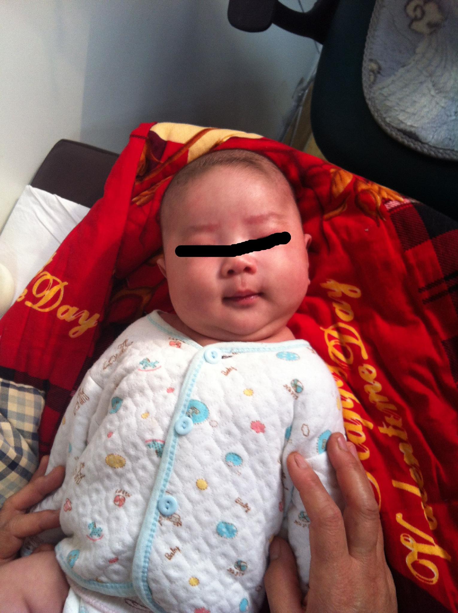 嬰兒痙攣性斜頸六個月