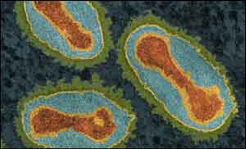 顯微鏡下天花病毒