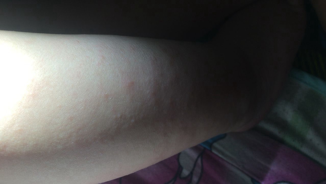 小孩得流感的症狀圖 