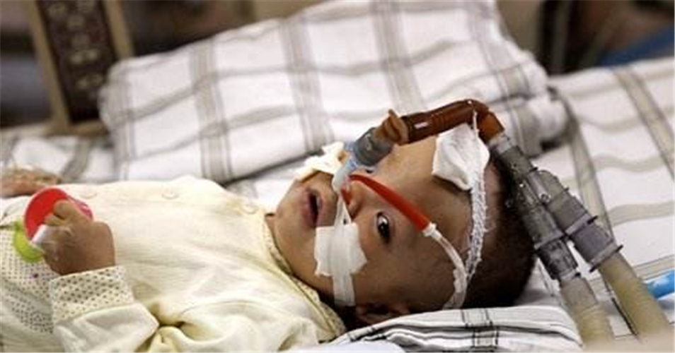 手足口病引發腦炎