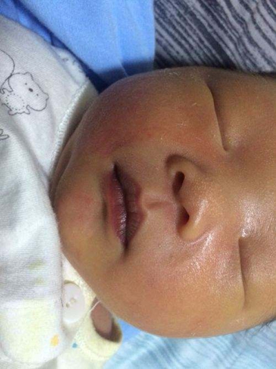 新生兒嘴唇發紫 (9) 