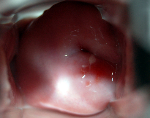 子宮肥大圖 (41) 