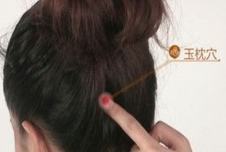 玉枕穴頭部穴位