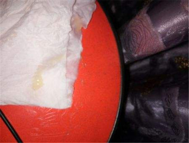 正常精子數量是多少 