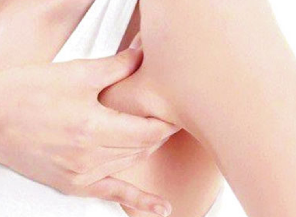 良性淋巴瘤症狀 