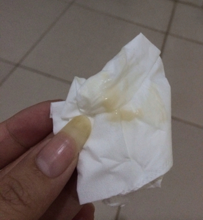 先兆流產分泌物