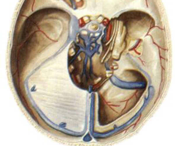 硬腦膜竇圖 
