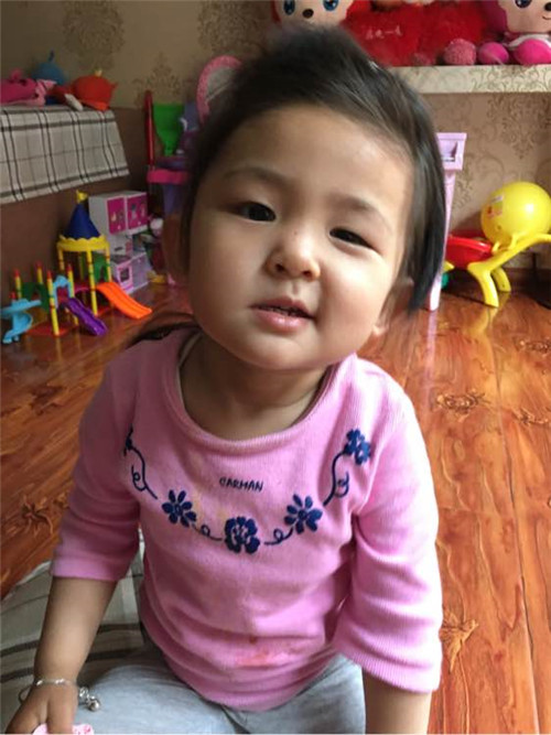 小孩面癱怎麼治的