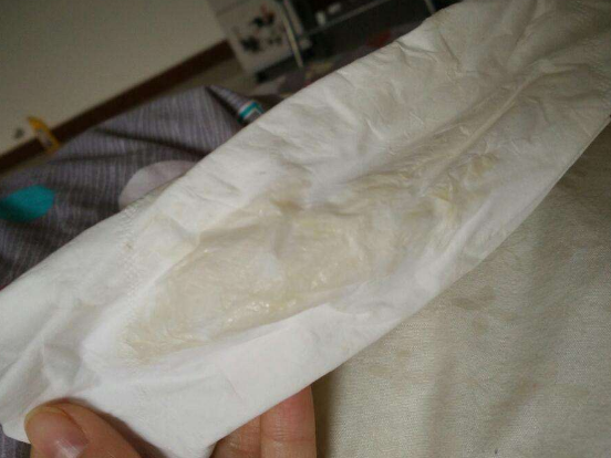 白帶帶有褐色分泌物 (7) 